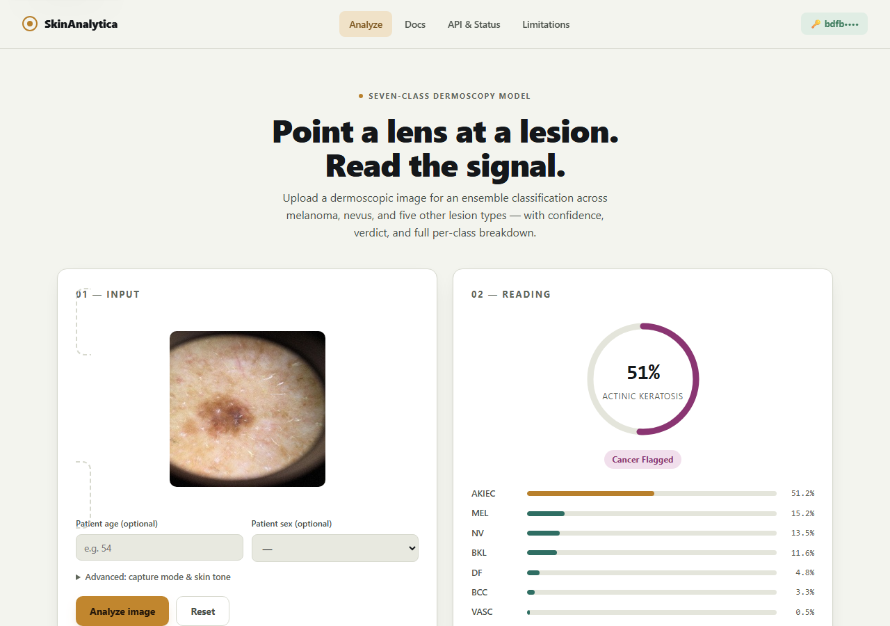 SkinAnalytica interface showing a dermoscopic lesion image analyzed as 51% Actinic Keratosis, flagged for cancer risk, with a full seven-class confidence breakdown